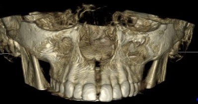 La revista Scientific Journal BMC Oral Health publica un articulo del estudio realizado por el Sr. Sanchez Riofrío